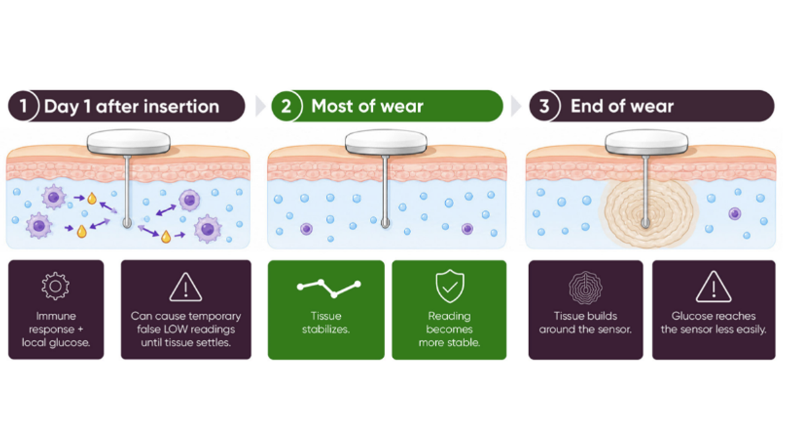 Figure that shows how CGM device is inserted into the skin